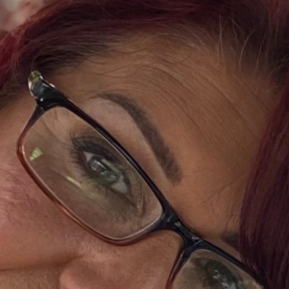 SALE 125$ - - Linetox 100 units plus filler - Picture 2 of 6